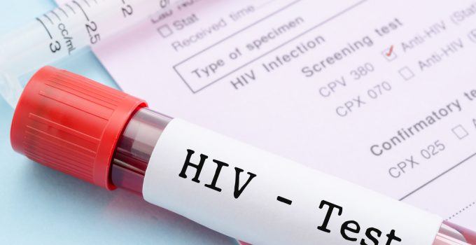 Significado de HIV